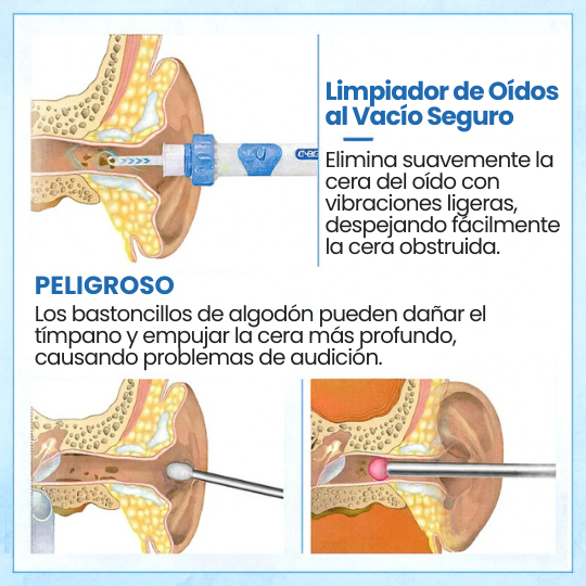 Limpiador de oidos electrico vibracion