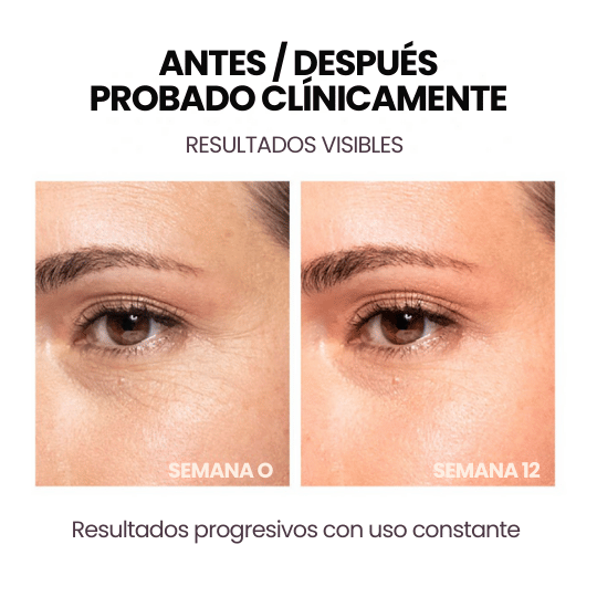 Masajeador Facial con Electro-estimulación y Micro-corriente Reafirma y Tonifica la piel - ¡Luce una Piel más Joven!